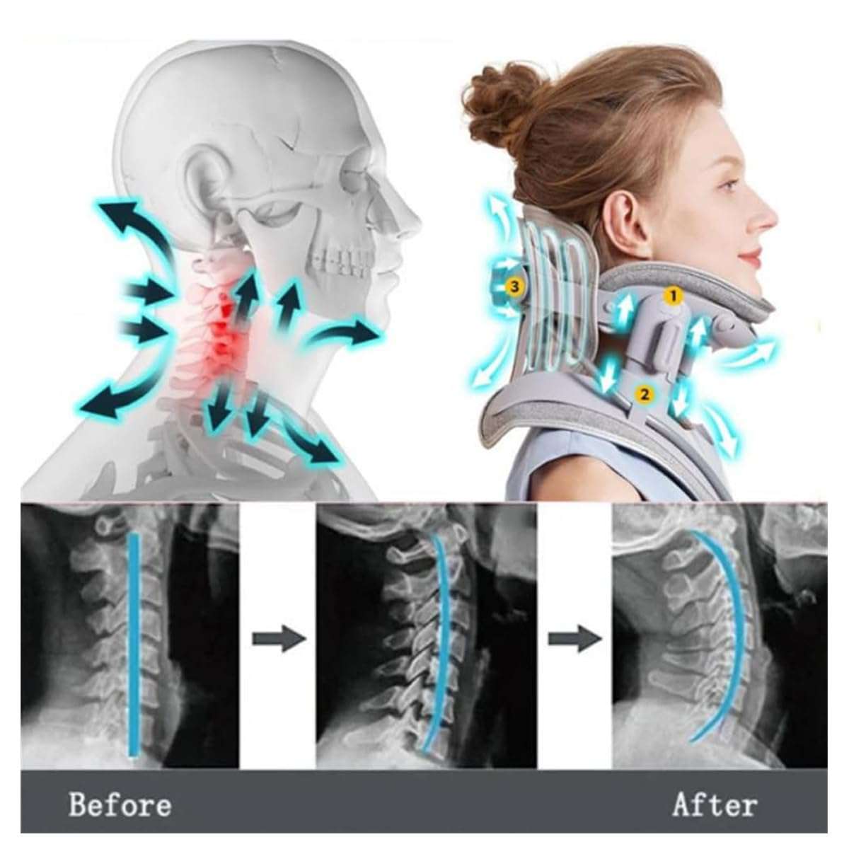 Cervical Neck Stretcher with 8 airbags and triple traction system for cervical spine decompression and posture correction.