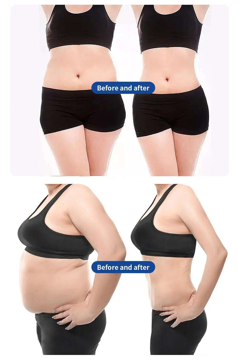 Before and after weight loss muscle stimulating body sculpting results showing reduced fat and toned abdomen and waist.